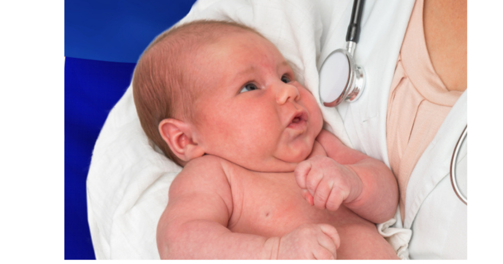 Varicose veins in pregnancy usually fade once baby arrives. Baby in arms of midwife.