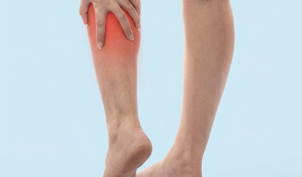 It looks like a deep vein thrombosis – how to understand and prevent DVT 