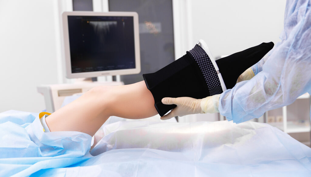 Surgeon,FIts,Patient,With,Compression,Stockings,After,Varicose,Vein,Treatment,With,Medical,Adhesive,Or,Radiofrequency.