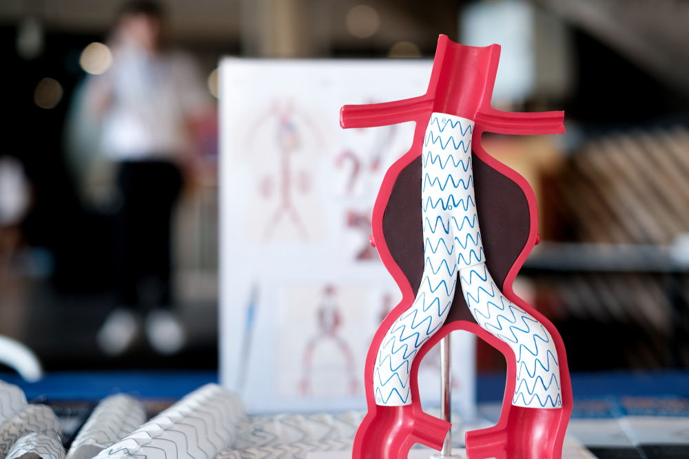 Model,Of,Aortic,Aneurysm,Repair,With,Stent,Insitu