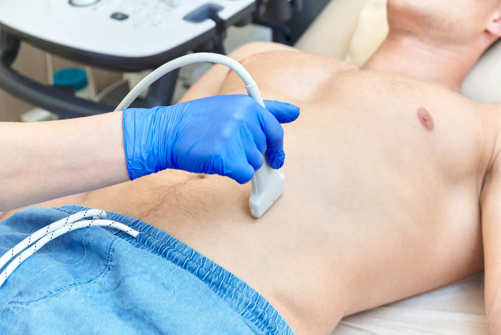 Ultrasound,Scan,Of,Abdomen,For,Aortic,Aneurysm