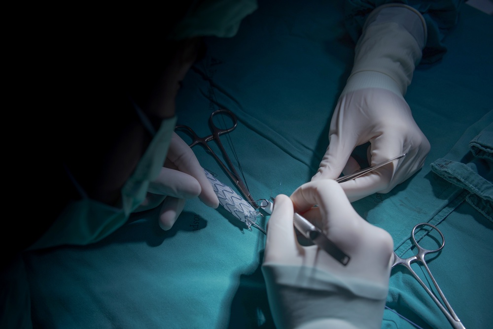 Vascular,Surgeon,Gets,Stent,Ready,For,Patient,With,Aortic,Aneurysm.