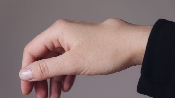 What’s the best way to deal with my ganglion cyst?