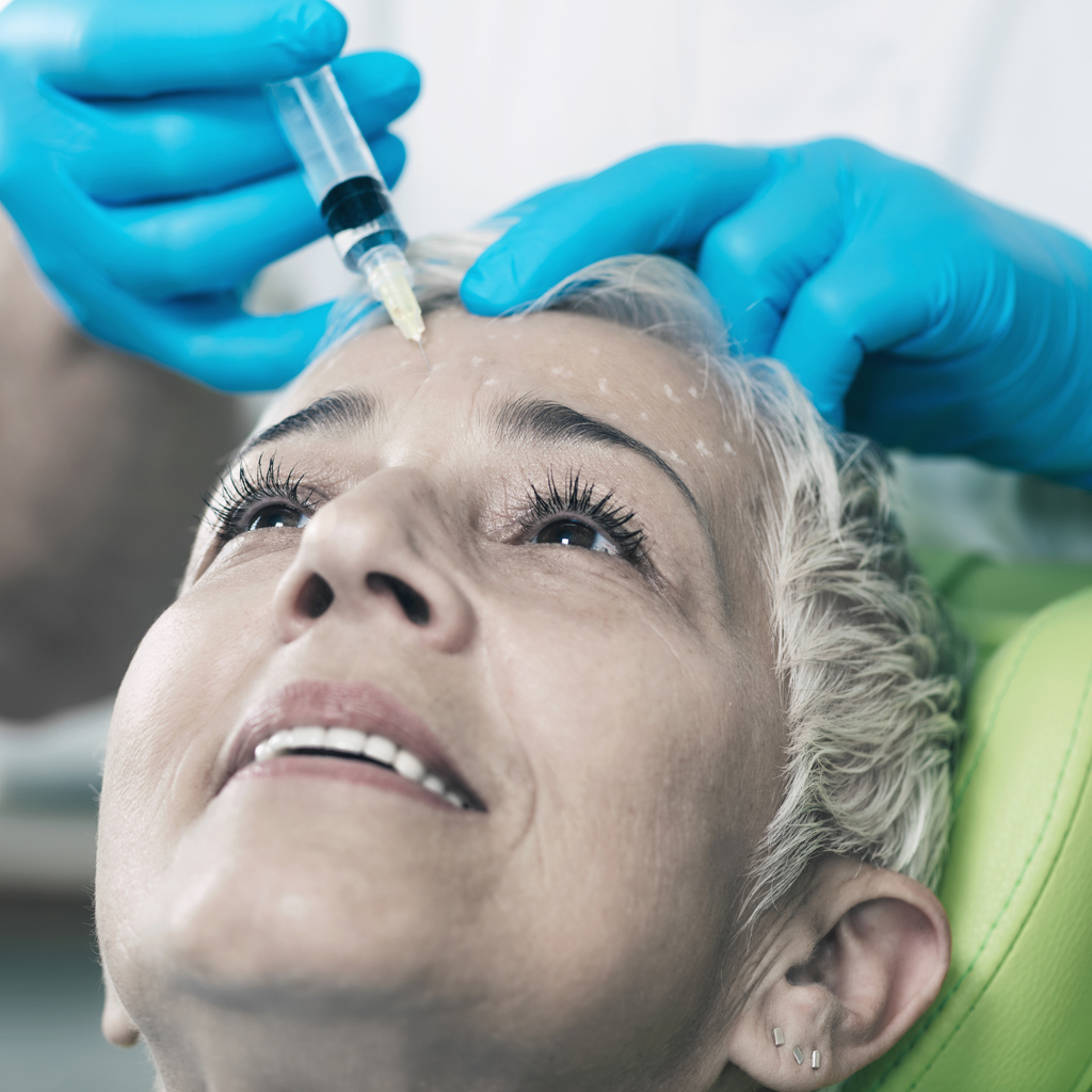 Woman with grey hair having injectables in forehead, white marks direct where the injection goes.